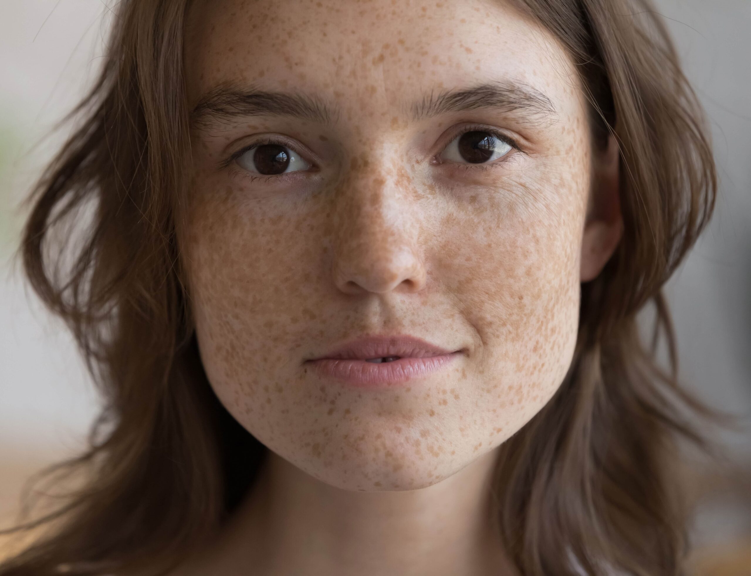 Woman with freckles looking at the screen.